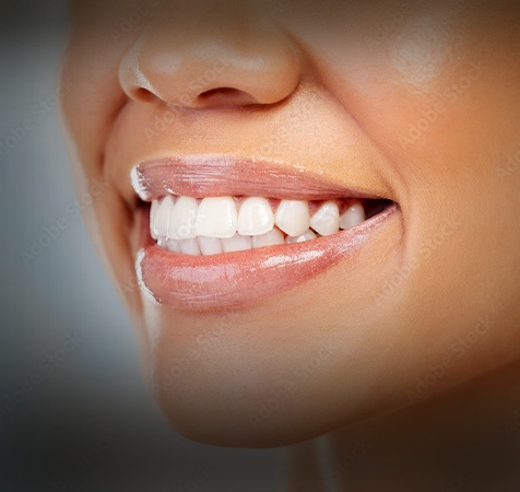 Crown Lengthening