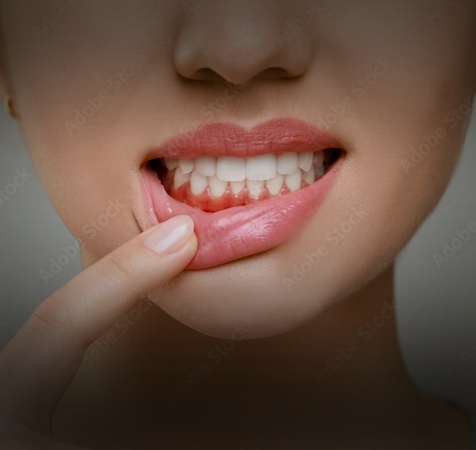 Dentures